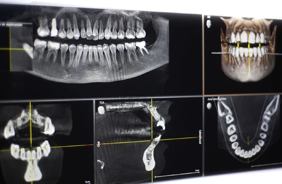 Cuánto cuesta una radiografía panorámica dental en Argentina 1 cuanto cuesta una radiografia panoramica dental en argentina