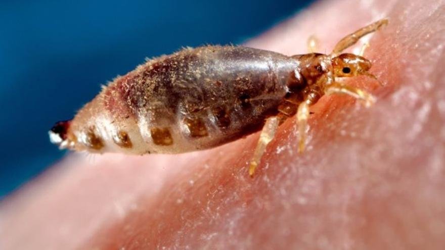 los piojos pueden aparecer por tristeza o estres