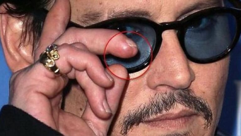 Por qué Johnny Depp mostró su dedo cercenado en el juicio contra Amber Heard 6 Por qué Johnny Depp mostró su dedo cercenado en el juicio contra Amber Heard