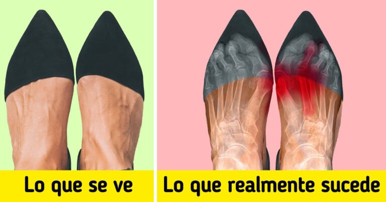 Por qué suceden cosas inesperadas con los zapatos que usamos