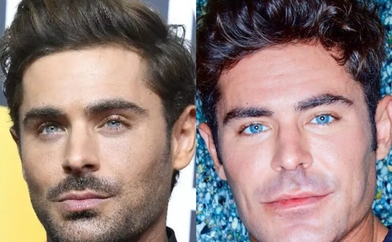 Zac Efron se sometió a una operación estética Todo lo que necesitas saber 3 Zac Efron se sometió a una operación estética Todo lo que necesitas saber