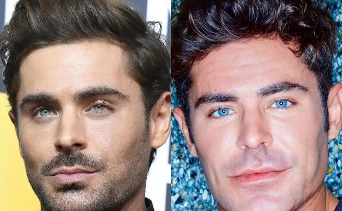 zac efron se sometio a una operacion estetica todo lo que necesitas saber